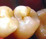 Изображение зубов