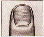Изображение ногтя