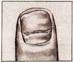 Изображение ногтя